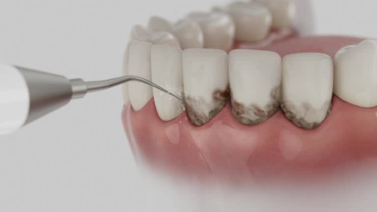 Trusted Wisdom Tooth Removal service in Rockvale, TN - Dentist Open Now